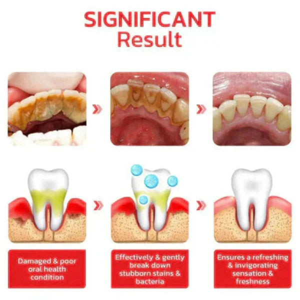 Probiotic Whitening Toothpaste (BUY1 GET 1 FREE )