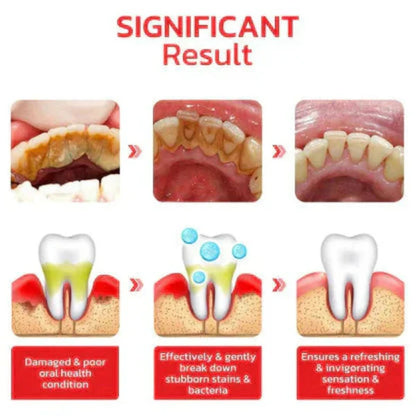 Probiotic Whitening Toothpaste (BUY1 GET 1 FREE )